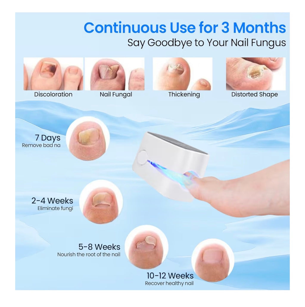 Nail Fungus Laser Device,