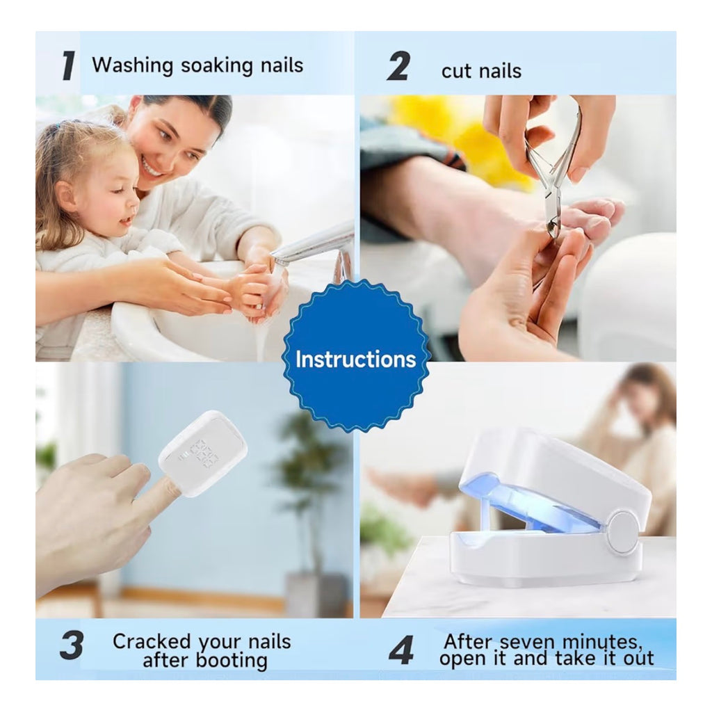 Nail Fungus Laser Device,