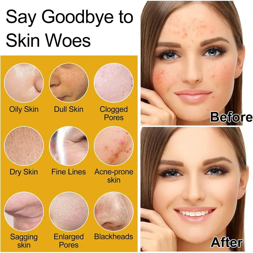 Rice water extract